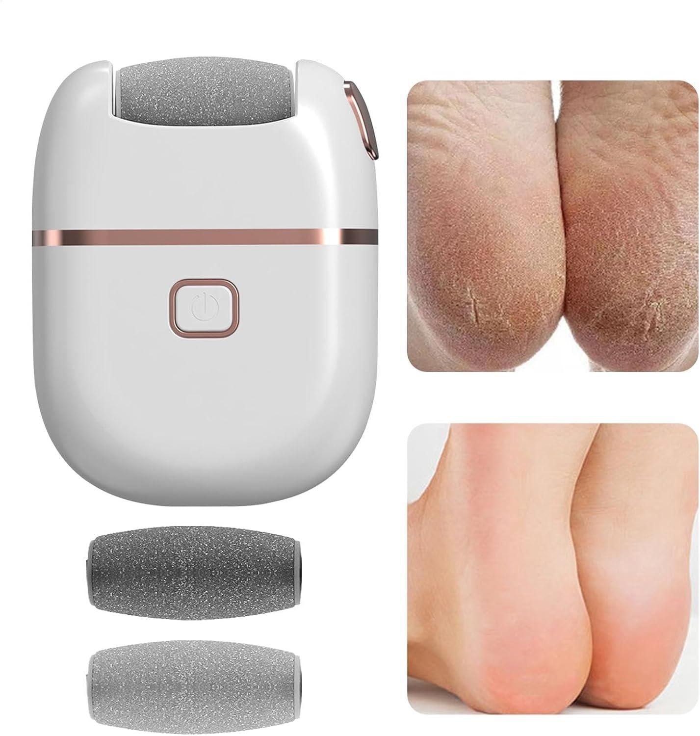 Electronic Pedicure Tool – Electric Callus Remover for Smooth, Soft Feet, Pack of 1