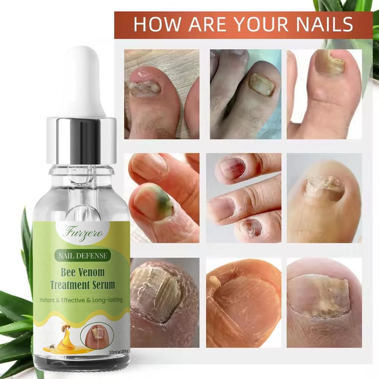 Furgero Nail Care Serum with Bee Venom Extract 30ml (Pack of 1)