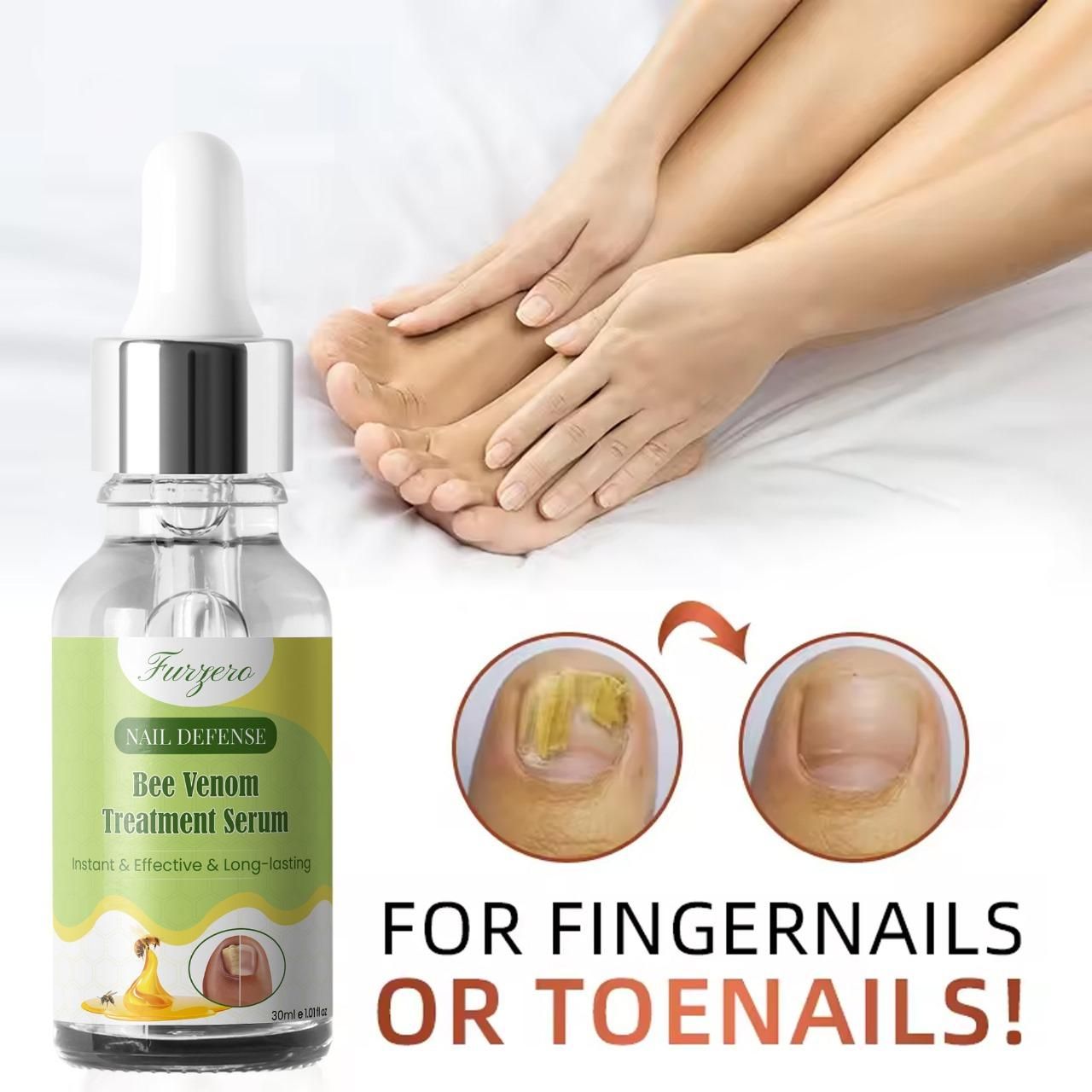 Furgero Nail Care Serum with Bee Venom Extract 30ml (Pack of 1)