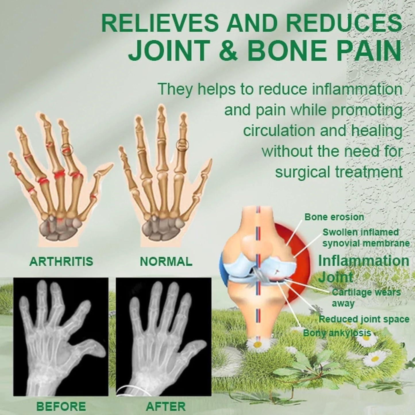 Bee Venom Mobility & Comfort Cream – Natural Support Bones care cream (Pack of 2 x 30g)