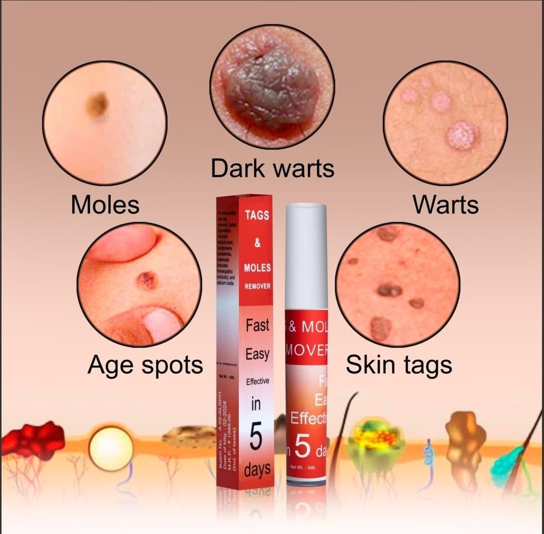 Skin Care Cream for Blemishes & Spots – 5ml (Pack of 1)