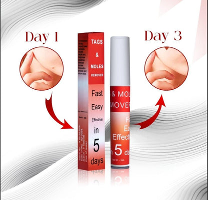 Skin Care Cream for Blemishes & Spots – 5ml (Pack of 1)