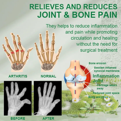 Bee Venom Mobility & Comfort Cream – Natural Support Bones care cream (Pack of 2 x 30g)